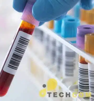 Decal in tem xét nghiệm bệnh viện 3 Dịch vụ in tem cho bệnh viện chất lượng bản in sắc nét , thời gian sử dụng lâu và giá thành hợp lý